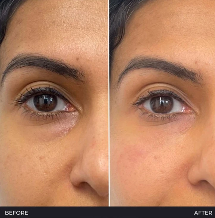 Advanced Aesthetics Wilmslow